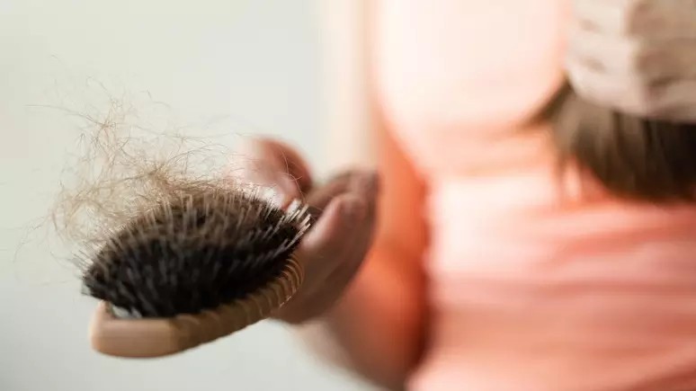 Queda capilar após uso de Mounjaro: efeito colateral comum pode ser evitado