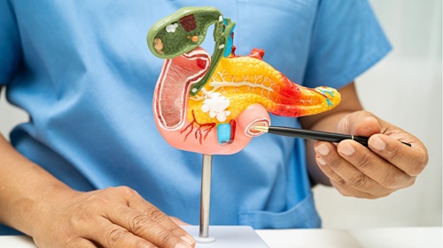 Médicos reforçam segurança das canetas e explicam que pancreatite pode ser consequência da rápida perda de peso