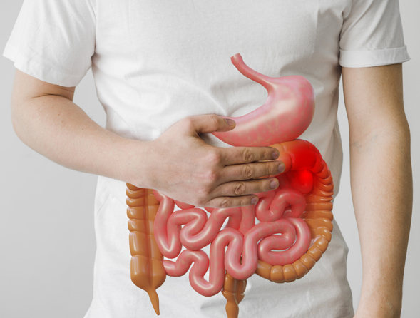 Câncer de intestino: quais alimentos ajudam na prevenção da doença? E quais aumentam o risco?